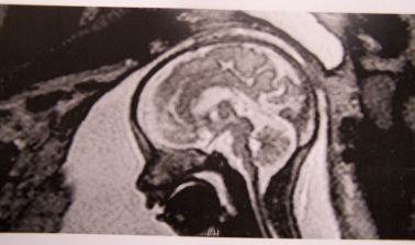 One of the MRI scans.